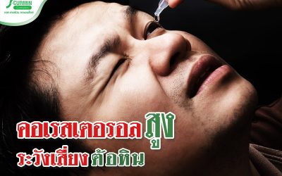คอเรสเตอรอลสูงมาก อาจต้องลาจาก ‘ดวงตา’