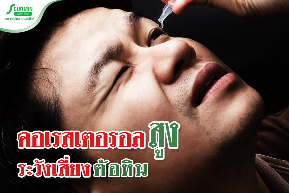 You are currently viewing คอเรสเตอรอลสูงมาก อาจต้องลาจาก ‘ดวงตา’