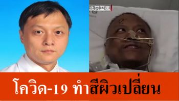 Read more about the article รู้ยัง! โควิดไม่เพียงทำปอดเสียหาย แต่ยังอาจทำลายตับ ดูแลด่วน!!