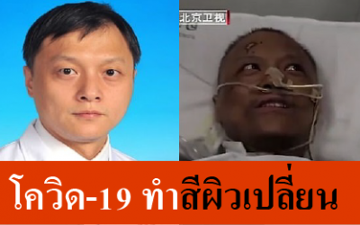 รู้ยัง! โควิดไม่เพียงทำปอดเสียหาย แต่ยังอาจทำลายตับ ดูแลด่วน!!